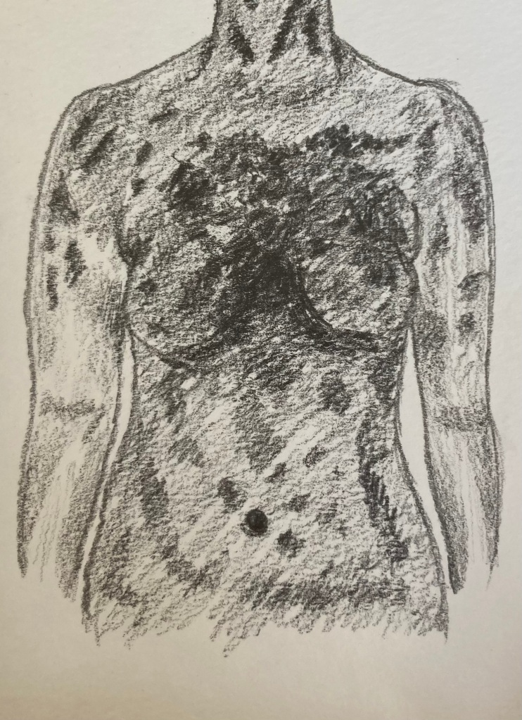 Pencil drawing of a thermal scan of a female depicting inflammation in her vascular system representative of bartonella. 